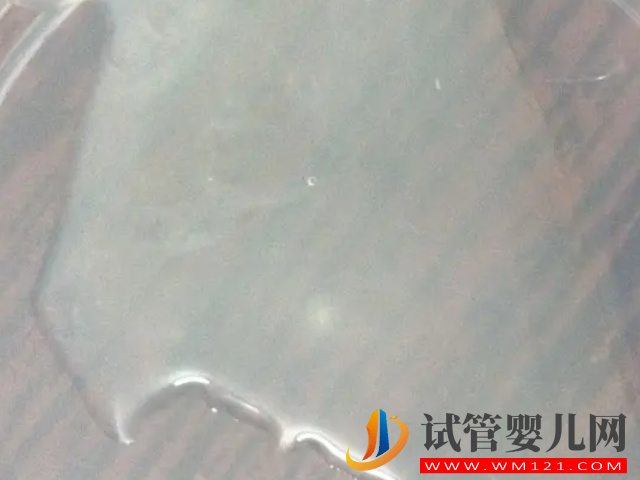 男性死精和活精差異盤點(diǎn),一張圖帶你兩者表面區(qū)別(圖2) 男性死精和活精差異盤點(diǎn),一張圖帶你兩者表面區(qū)別(圖2)