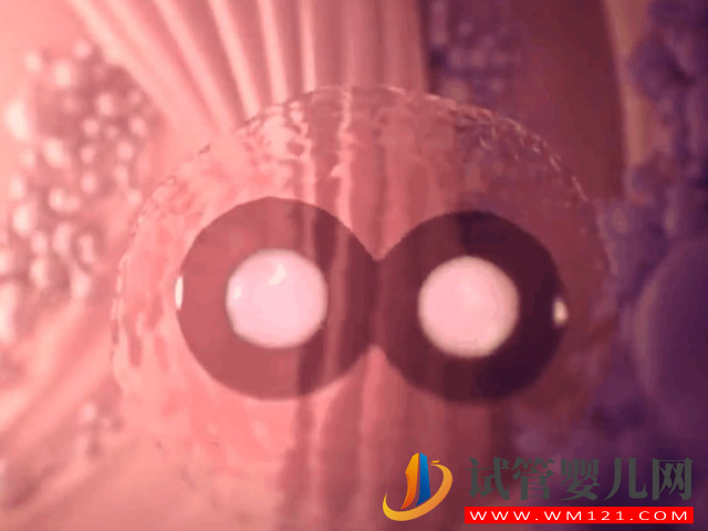 孕早期頻繁性饑餓感強烈要警惕，4個細節(jié)告訴你是不是胎停(圖1)