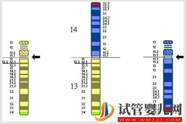 詳解女方羅氏易位遺傳規律，生育男孩也有概率被遺傳(圖2)