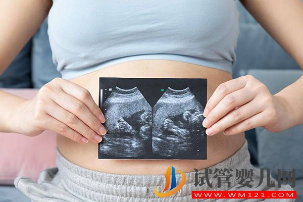 胚胎出現(xiàn)16號(hào)染色體三體的原因有4點(diǎn),是偶然or遺傳來看(圖2) 胚胎出現(xiàn)16號(hào)染色體三體的原因有4點(diǎn),是偶然or遺傳來看(圖2)