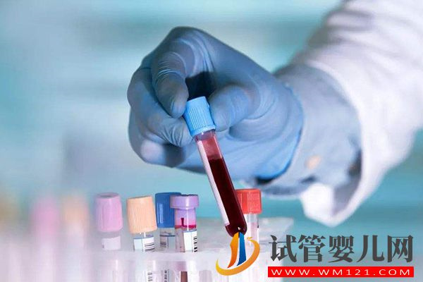 喝豆漿三個月睪酮降了是正常現象，會不會升高因人而異(圖3)