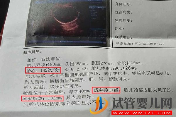 bpd、hc、ac、fl正常值對照表一覽，附B超數據看男女方法(圖2)