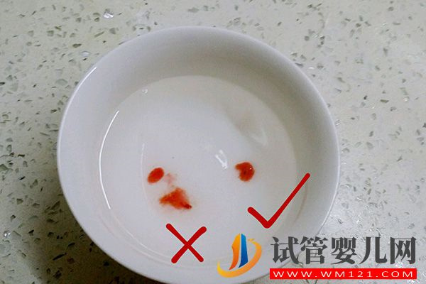 教你10招判斷孩子是否親生，外貌、血型等土方法可了解(圖3)