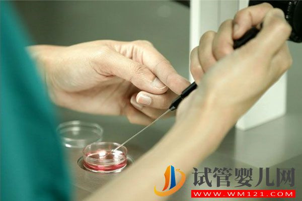 試管嬰兒流程步驟說明(圖5)