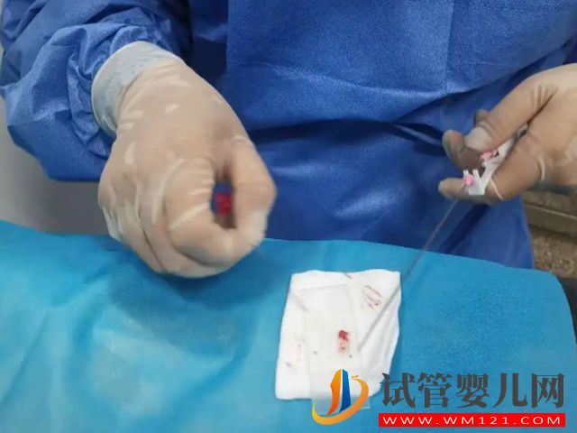 睪丸穿刺手術(shù)費(fèi)用清單,術(shù)前檢查+手術(shù)費(fèi)不超過(guò)這個(gè)數(shù)(圖2) 睪丸穿刺手術(shù)費(fèi)用清單,術(shù)前檢查+手術(shù)費(fèi)不超過(guò)這個(gè)數(shù)(圖2)