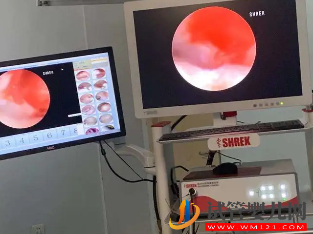 試管移植前這4類人群必做宮腔鏡，能大大提升成功率(圖1)