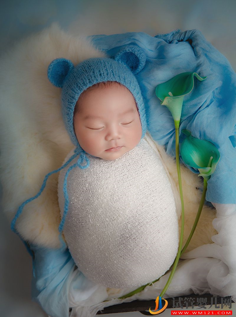 孕前期NT檢查是查什么？什么是NT檢查？(圖1)