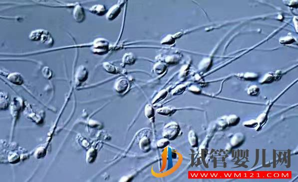 關于男性少精弱精那些事(圖1)