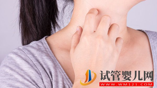 白塞病臨床表現有哪些？可以懷孕生子嗎？(圖1)