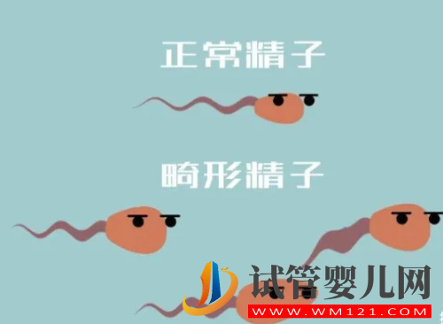 精子頭部畸形有什么影響，胎兒會產生畸形嗎？81次閱讀(圖1)