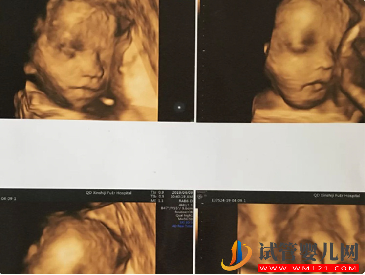 四維單子上3個亮點是男孩 思維單子怎么看男看女(圖1)