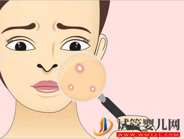 美卓樂與強的松對比分析，3大區別告訴你哪個好(圖2)