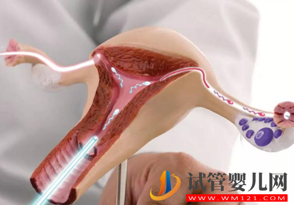 卵子老化的大齡女性看過來，第四代試管嬰兒幫你圓夢(圖2)