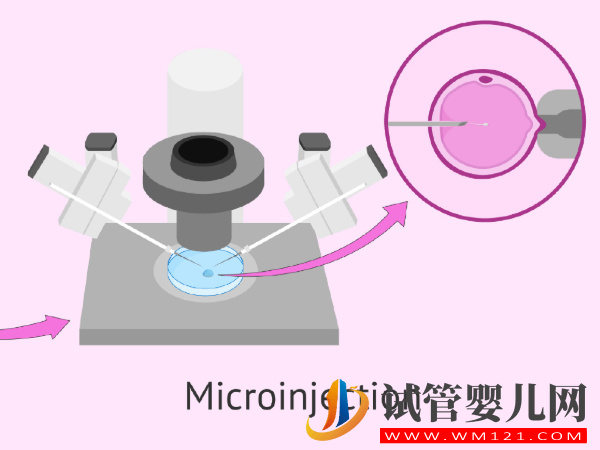 大齡女性生育有望，據透露第四代試管能提高30%妊娠率(圖2)