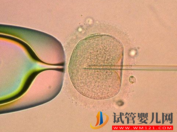 你不知道的第四代試管嬰兒優(yōu)缺點，和一二三代都不同(圖3)