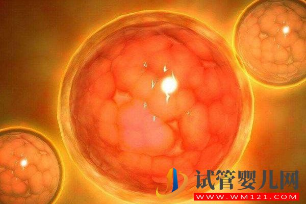 多囊卵巢綜合癥臨床表現有那些？(圖1)