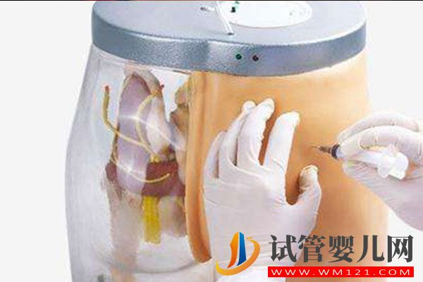 hmg治療卵泡萎縮效果好，注射也需謹慎(圖3)