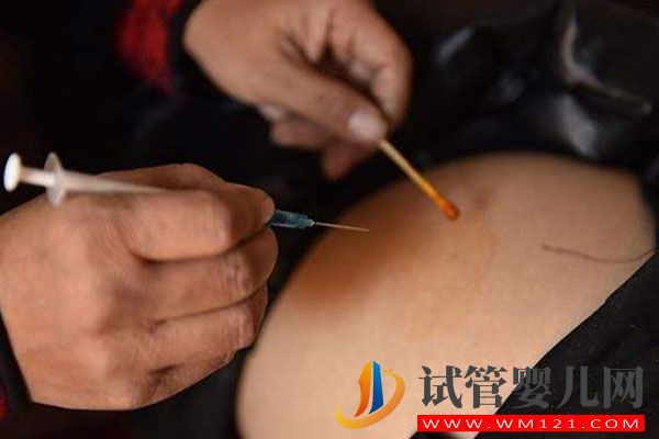 hmg治療卵泡萎縮效果好，注射也需謹慎(圖2)