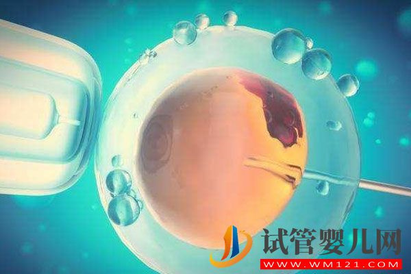 卵巢囊腫對試管助孕有影響嗎？聽聽專家怎么說(圖1)