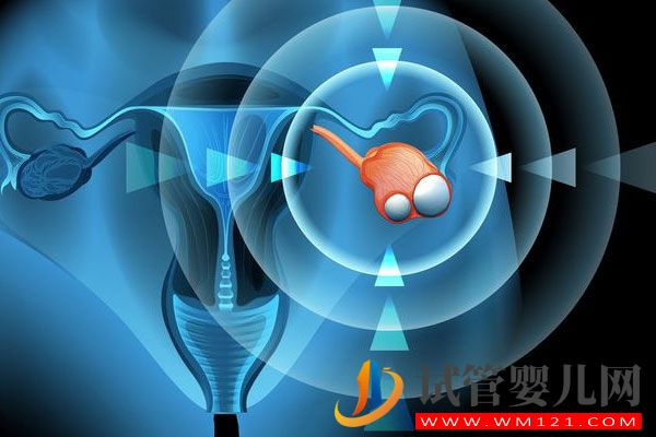 卵巢囊腫對試管助孕有影響嗎？聽聽專家怎么說(圖2)