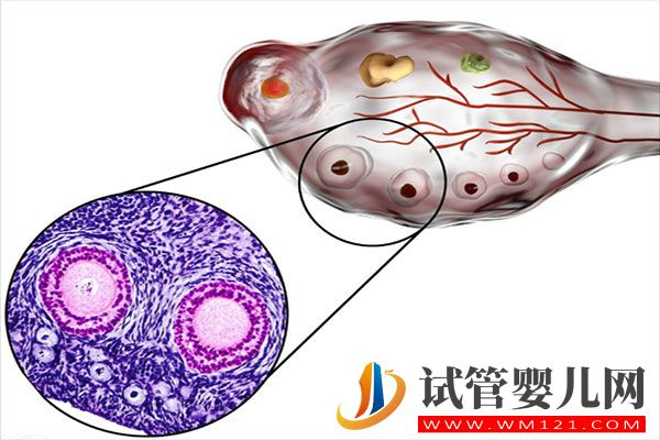 試管嬰兒促排期間注意事項有哪些呢？(圖1)