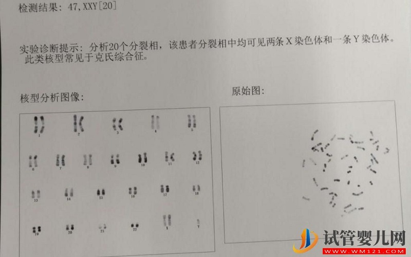 男性染色體異常是可以做試管嬰兒的嗎?(圖1)