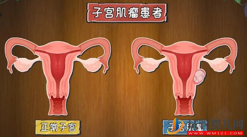 影響試管嬰兒成功率的子宮內環境有哪些(圖2)