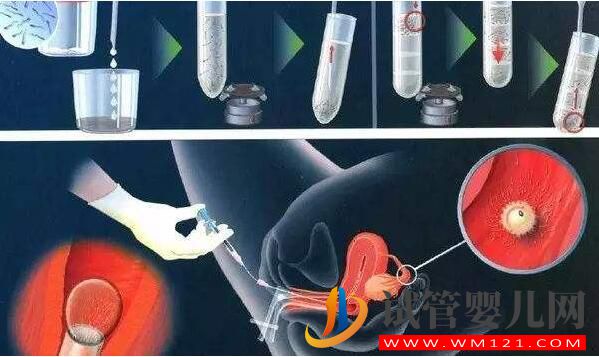 做試管移植前憋尿到底是為什么?(圖1) 做試管移植前憋尿到底是為什么?(圖1)