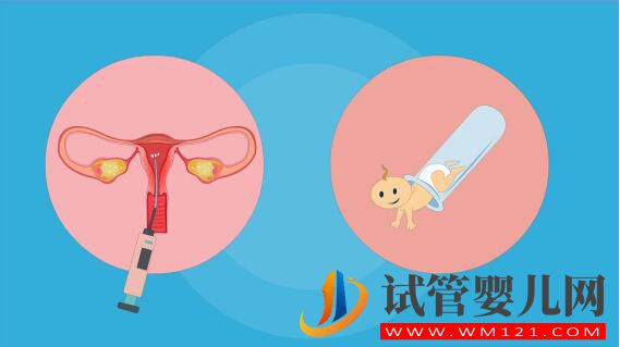 人工授精和試管嬰兒詳細介紹及對比？(圖3)