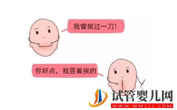 女人多少歲后不能做試管嬰兒?(圖4) 女人多少歲后不能做試管嬰兒?(圖4)