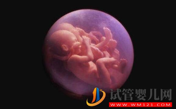 試管雙胞胎幾率有多大?醫生:比自然懷雙胞胎大的多(圖1) 試管雙胞胎幾率有多大?醫生:比自然懷雙胞胎大的多(圖1)