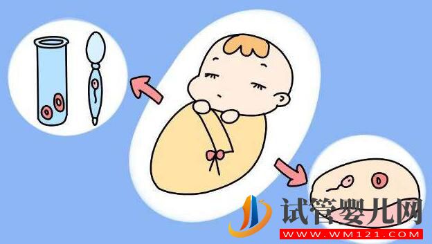 高齡婦女為什么要選擇試管嬰兒？(圖3)