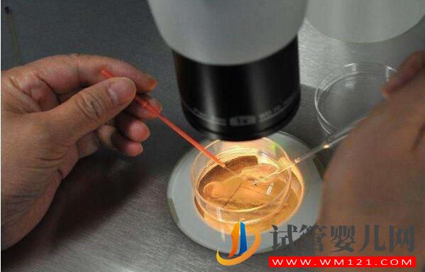 做試管嬰兒取多少個卵子合適？(圖2)