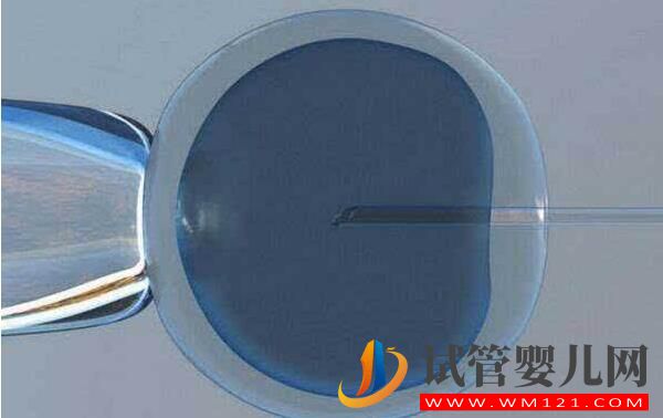 哪些情況?會(huì)建議做試管？做試管嬰兒緩解壓力的方式(圖3)