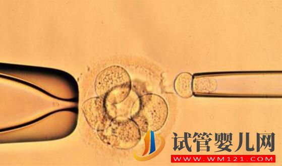 解答做試管嬰兒的人非常擔心的幾個問題(圖6)
