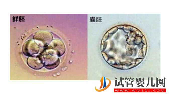 試管嬰兒中凍胚和鮮胚有什么不同？不選鮮胚的原因(圖3)
