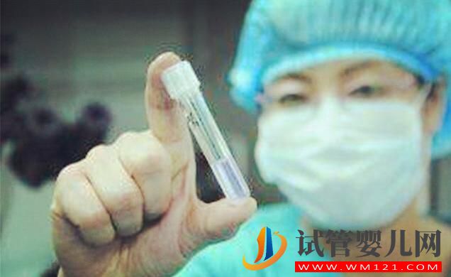 試管嬰兒對男方精子有什么要求，快來記下吧(圖2)