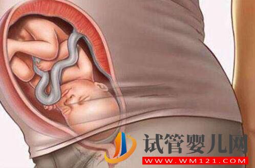 做試管嬰兒的全部流程和費(fèi)用 全部做完要多長時(shí)間(圖2) 做試管嬰兒的全部流程和費(fèi)用 全部做完要多長時(shí)間(圖2)