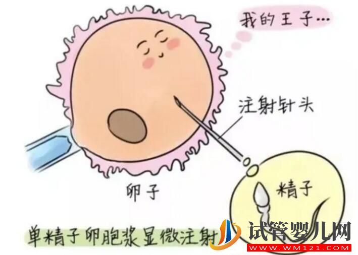 國內試管嬰兒全過程和試管注意事項介紹(圖2)