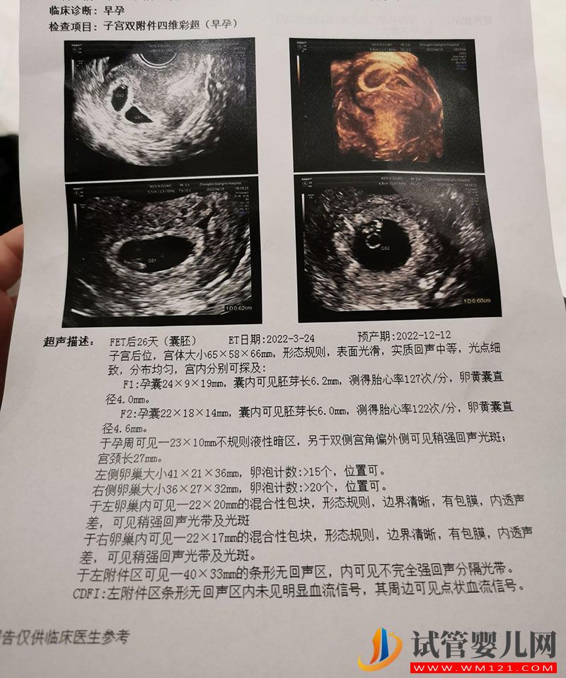 包生男孩就找第三代試管是真的嗎?(圖1)