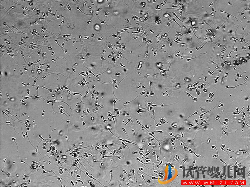 想生兒子怎么備孕才能讓男性的Y精子增多(圖1)