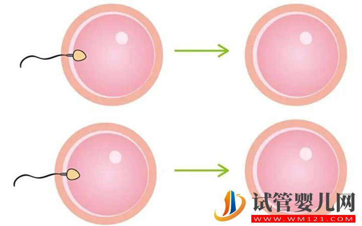 試管想要雙胞胎！患有弓形子宮必須滿足4個條件才行(圖1)