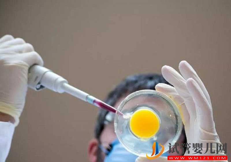 生同卵雙胞胎決定性因素分析，來對照下你中了幾點？(圖5)