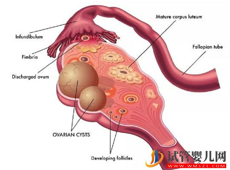 生同卵雙胞胎決定性因素分析，來對照下你中了幾點？(圖4)