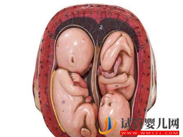 什么時間同房最容易懷雙胞胎呢？(圖1)