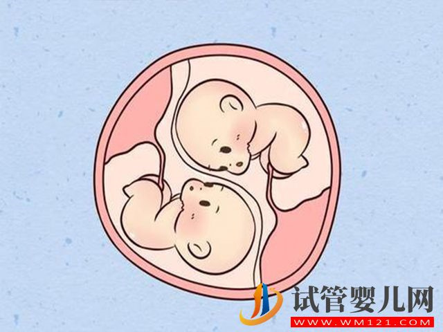 懷雙胎的孕婦會(huì)比懷單胎的血糖更高嗎？(圖1)