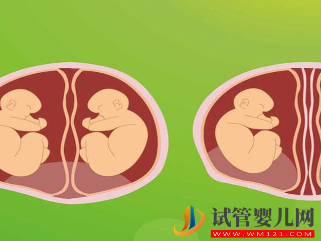 試管嬰兒中的“單卵雙胎”可不是好事,早產(chǎn)、畸形風(fēng)險(xiǎn)高(圖5) 試管嬰兒中的“單卵雙胎”可不是好事,早產(chǎn)、畸形風(fēng)險(xiǎn)高(圖5)
