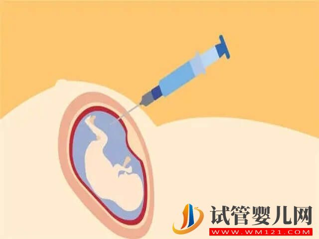 雙胞胎除了唐篩,還有哪些產(chǎn)檢做不了?(圖2) 雙胞胎除了唐篩,還有哪些產(chǎn)檢做不了?(圖2)