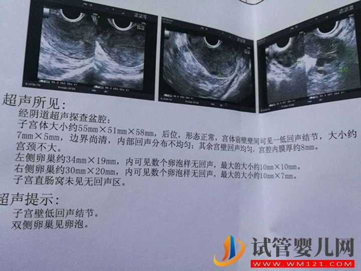 這四種癥狀需監(jiān)測(cè)卵泡!監(jiān)測(cè)期間需注意這些事項(xiàng)(圖1) 這四種癥狀需監(jiān)測(cè)卵泡!監(jiān)測(cè)期間需注意這些事項(xiàng)(圖1)