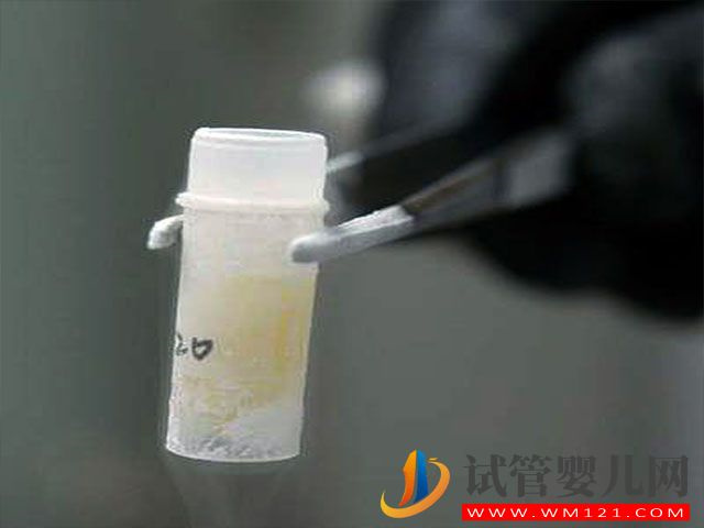 國外的艾滋病患者洗精術(shù)靠譜嗎?(圖1) 國外的艾滋病患者洗精術(shù)靠譜嗎?(圖1)